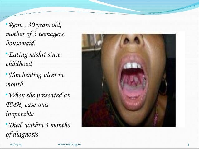 lip cancer from tobacco in teens Teahcer having sex with student